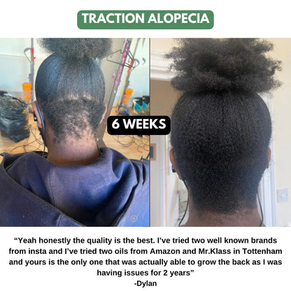 The Ultimate Hair Growth Set for Textured Hair